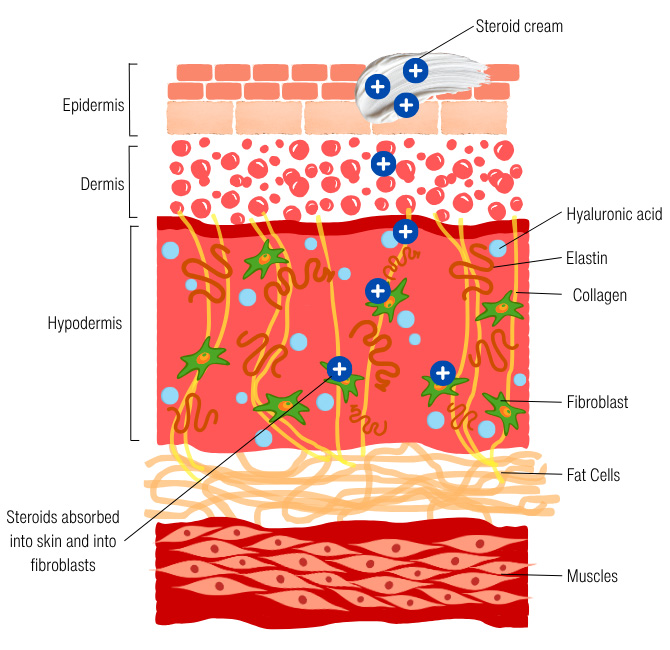 Skin structure and the absorption of steroids into skin cells.