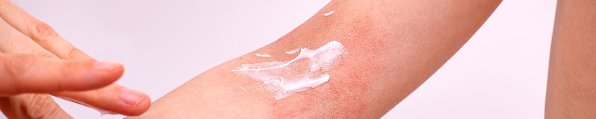 Use steroid-free skincare