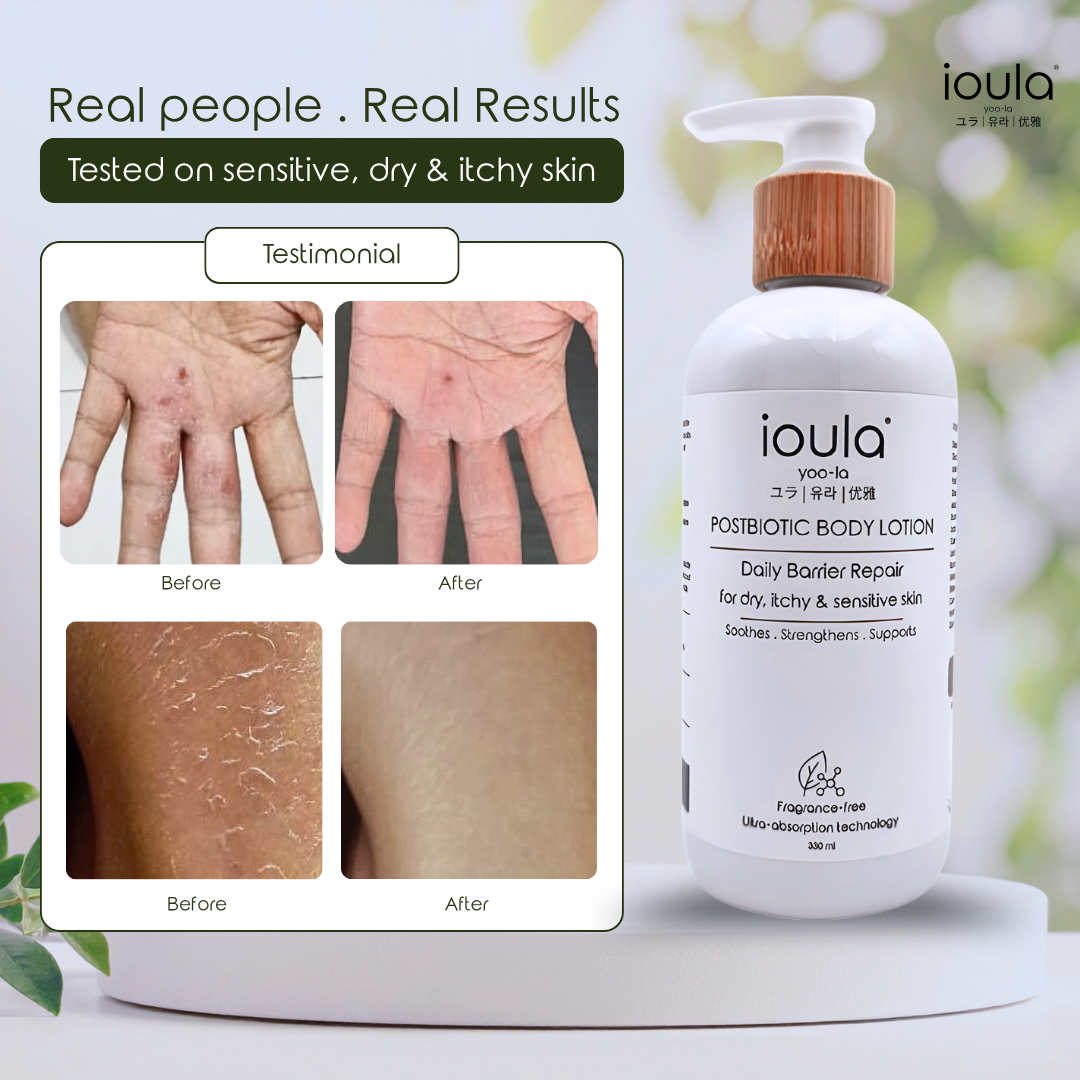 ioula Postbiotic Body Lotion 330 ml - Image 2